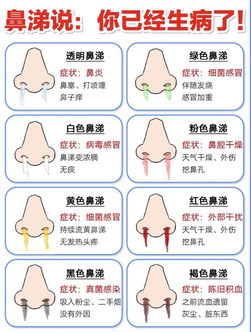 鼻炎类型