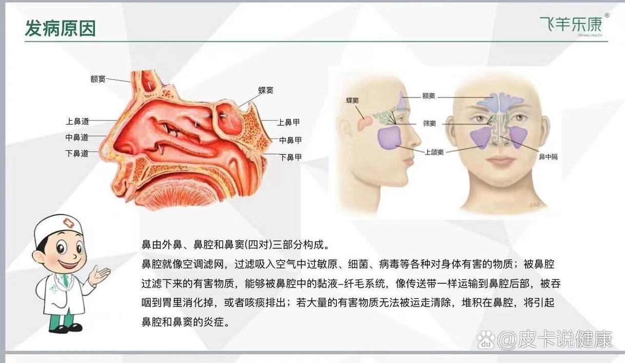 细菌性鼻炎