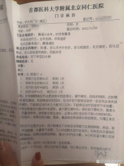 北京鼻炎治疗价格是多少？