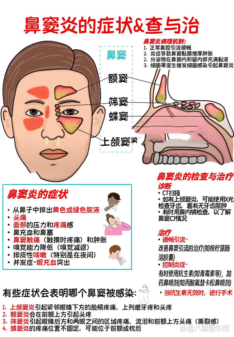 鼻炎早期都有哪些症状表现？