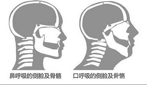 口呼吸习惯