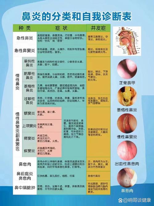 鼻炎会影响你的职场表现吗？