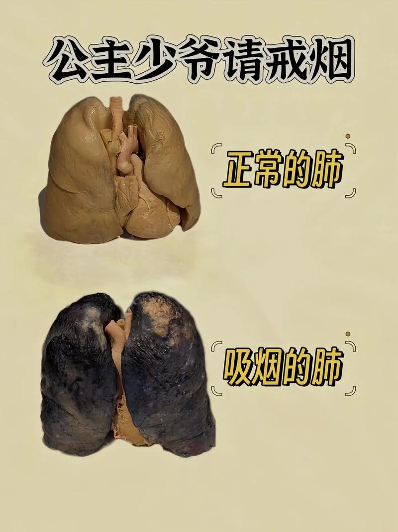 抽烟危害