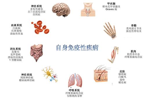 自身免疫性疾病